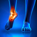 Choosing the Right Specialist for Foot and Ankle Pain: A Comprehensive Guide