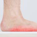 Expert Insights: Understanding Ankle Pain