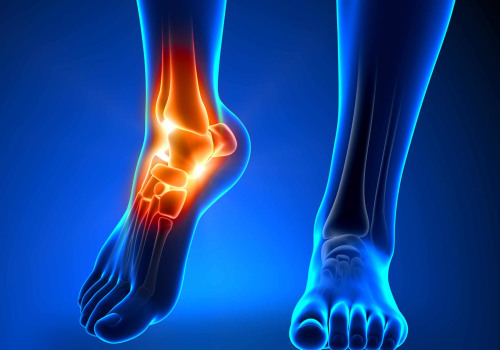 Choosing the Right Specialist for Foot and Ankle Pain: A Comprehensive Guide