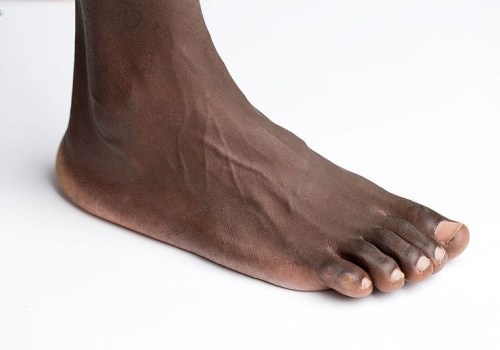 Choosing the Best Doctor for Foot and Ankle Problems