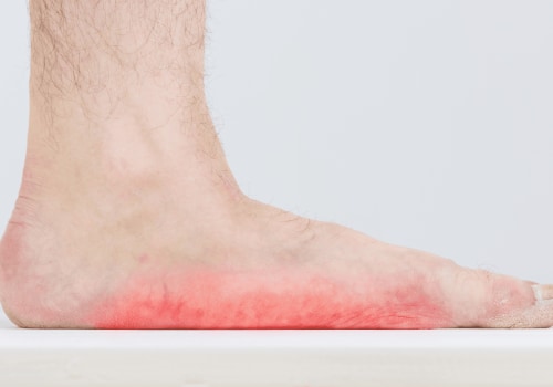 Expert Insights: Understanding Ankle Pain